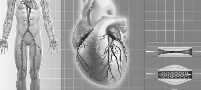 PremiumContentLibrary_Cardiology_Aortic Stenosis and Dyslipidemia