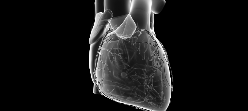 PremiumContentLibrary_Cardiology_Transcatheter or surgical Aortic valve replacement