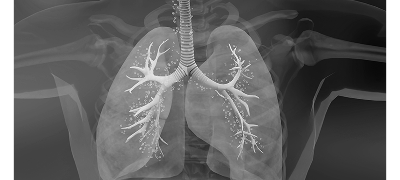 Anaphylaxis: first clinical presentation, subsequent referral practise, and suspected elicitor—an observational study