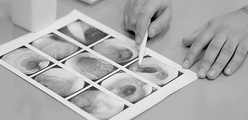 Colorectal Neoplasia Prevalence at ≥10-Year Follow-Up Screening Colonoscopy