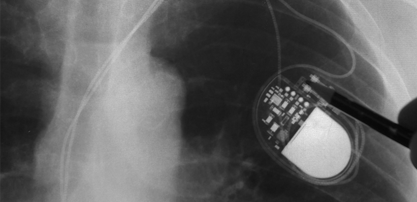 Ionizing Radiation, Even at Low Doses, Imparts Cardiovascular Risk