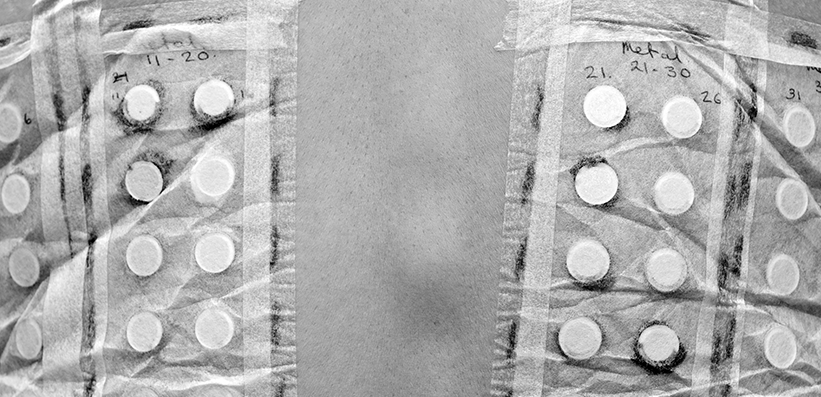 The role of the atopy patch test in the diagnostic work‑up of non‑IgE gastrointestinal food allergy in children: a systematic review