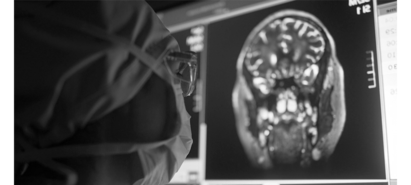 Effect of photobiomodulation therapy on headache, and fatigue in patients with chronic rhinosinusitis: a randomized controlled study