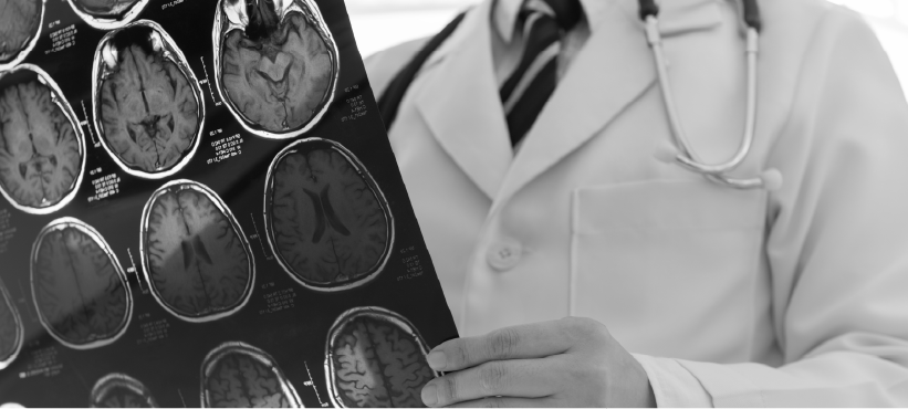 PremiumContentLibrary_Psiquiatría_Associations Between Mental Disorders and Subsequent Medical Condition