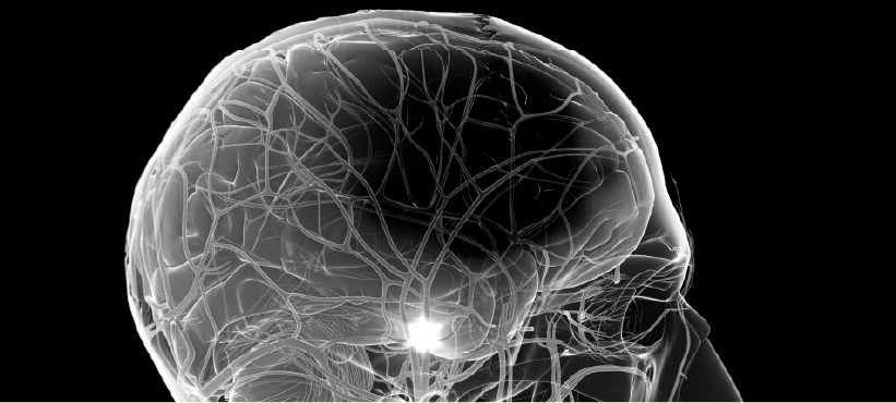 PremiumContentLibrary_Psiquiatría_MRI Scores for Cerebral Small Vessel Disease 