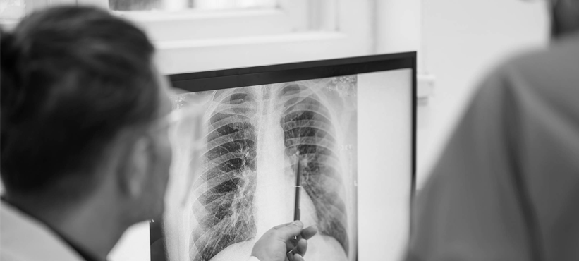 Pulmonary Rehabilitation After Hospitalization for COPD Exacerbations 