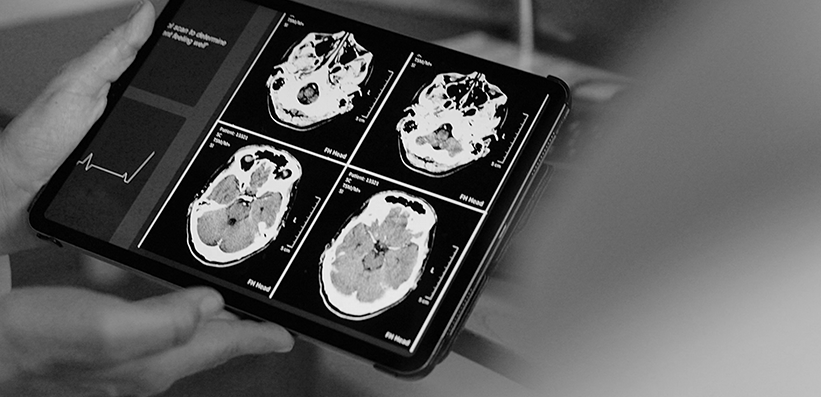 Occipital transcranial direct current stimulation in episodic migraine patients: effect on cerebral perfusion