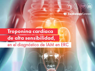 NOTICIAS_HEALTH CONNECT_CARDIOLOGY CONNECT